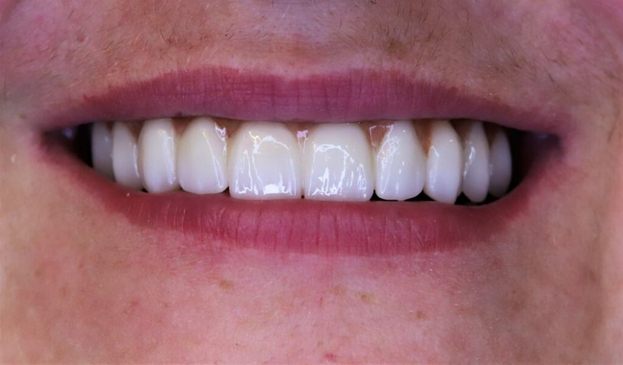 Slider image (4) Dentech Dental Centar